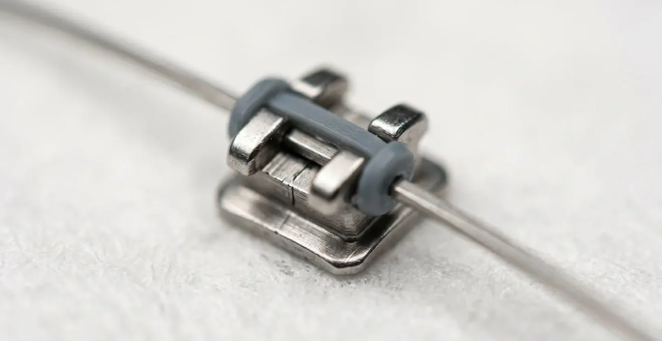 Concept de planification financière pour les soins orthodontiques en famille